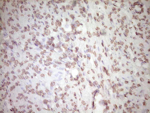 PLAT / TPA Antibody - Immunohistochemical staining of paraffin-embedded Human endometrium tissue within the normal limits using anti-PLAT mouse monoclonal antibody. (Heat-induced epitope retrieval by 1 mM EDTA in 10mM Tris, pH8.5, 120C for 3min,