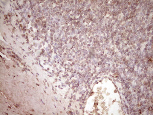 PLAT / TPA Antibody - Immunohistochemical staining of paraffin-embedded Human tonsil within the normal limits using anti-PLAT mouse monoclonal antibody. (Heat-induced epitope retrieval by 1 mM EDTA in 10mM Tris, pH8.5, 120C for 3min,