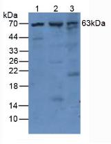PLAT / TPA Antibody - Western Blot; Sample. Lane1: Human Mcf7 Cells; Lane2: Mouse Pancreas Tissue; Lane3: Mouse Kidney Tissue.