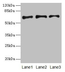 PLAT / TPA Antibody - Western blot All lanes: tissue -type plasminogen activator antibody at 16µg/ml Lane 1: Jurkat whole cell lysate Lane 2: Mouse stomach tissue Lane 3: Mouse kidney tissue Secondary Goat polyclonal to rabbit IgG at 1/10000 dilution Predicted band size: 63, 33, 58, 45 kDa Observed band size: 63 kDa