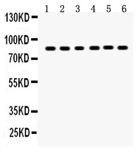 PLAT / TPA Antibody - TPA antibody Western blot. All lanes: Anti TPA at 0.5 ug/ml. Lane 1: Mouse Lung Tissue Lysate at 50 ug. Lane 2: Mouse Testis Tissue Lysate at 50 ug. Lane 3: U87 Whole Cell Lysate at 40 ug. Lane 4: A431 Whole Cell Lysate at 40 ug. Lane 5: A375 Whole Cell Lysate at 40 ug. Lane 6: A549 Whole Cell Lysate at 40 ug. Predicted band size: 85 kD. Observed band size: 85 kD.