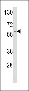 PLAT / TPA Antibody - Western blot of TPA Antibody in A2058 cell line lysates (35 ug/lane). TPA (arrow) was detected using the purified antibody.