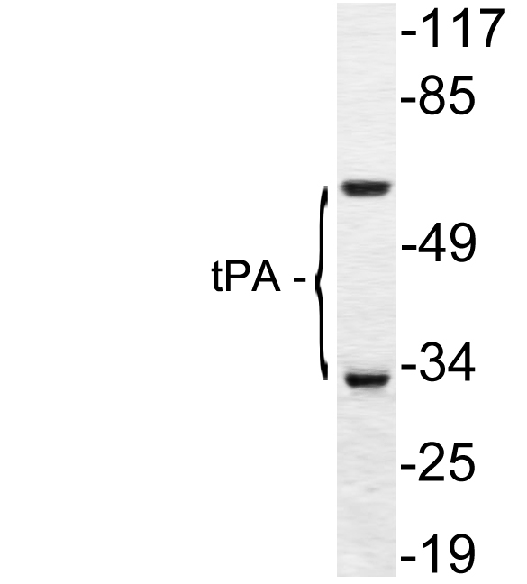 PLAT / TPA Antibody - Western blot analysis of lysate from A549 cells, using tPA antibody.