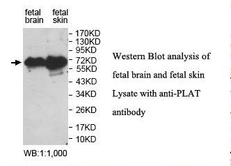 PLAT / TPA Antibody