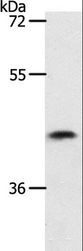 PLAT / TPA Antibody - Western blot analysis of 231 cell, using PLAT Polyclonal Antibody at dilution of 1:450.
