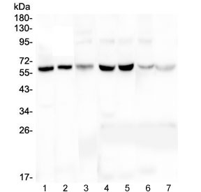 PLAT / TPA Antibody - Western blot testing of 1) human HeLa, 2) human U-2 OS, 3) human U-87 MG, 4) rat liver, 5) rat kidney, 6) mouse liver and 7) mouse kidney lysate with tPA antibody at 0.5ug/ml. Expected molecular weight: 64-70 kDa.