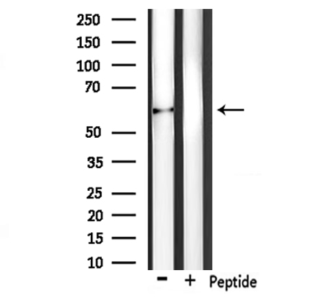 PLAT / TPA Antibody - Western blot analysis of extracts of rat liver tissue using PLAT antibody.