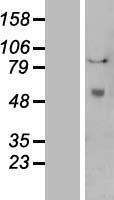 PLAT / TPA Protein - Western validation with an anti-DDK antibody * L: Control HEK293 lysate R: Over-expression lysate