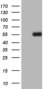 PLAU / Urokinase / uPA Antibody - HEK293T cells were transfected with the pCMV6-ENTRY control. (Left lane) or pCMV6-ENTRY PLAU. (Right lane) cDNA for 48 hrs and lysed. Equivalent amounts of cell lysates. (5 ug per lane) were separated by SDS-PAGE and immunoblotted with anti-PLAU.