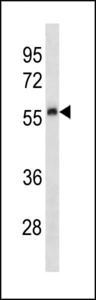 PLAU / Urokinase / uPA Antibody - Mouse Plau Antibody western blot of human placenta tissue lysates (35 ug/lane). The Mouse Plau antibody detected the Mouse Plau protein (arrow).