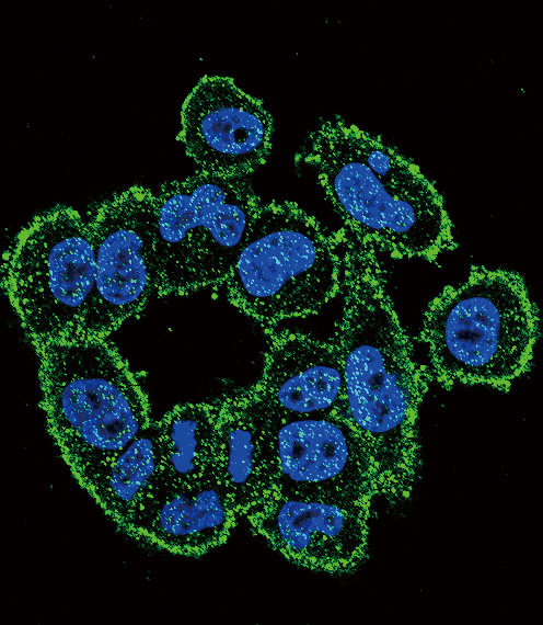 PLAU / Urokinase / uPA Antibody - Confocal immunofluorescence of Urokinase (PLAU) Antibody with A2058 cell followed by Alexa Fluor 488-conjugated goat anti-rabbit lgG (green). DAPI was used to stain the cell nuclear (blue).