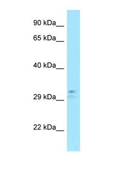 PLAU / Urokinase / uPA Antibody - PLAU antibody Western blot of Fetal Heart lysate. Antibody concentration 1 ug/ml.  This image was taken for the unconjugated form of this product. Other forms have not been tested.