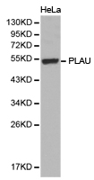 PLAU / Urokinase / uPA Antibody - Western blot of extracts of HeLa cell lines, using PLAU antibody.