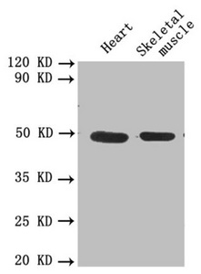 PLAU / Urokinase / uPA Antibody - Western blot All lanes: PLAU antibody at 1.8µg/ml Lane 1: Mouse heart tissue Lane 2: Mouse skeletal muscle tissue Secondary Goat polyclonal to rabbit IgG at 1/10000 dilution Predicted band size: 49, 47 kDa Observed band size: 49 kDa
