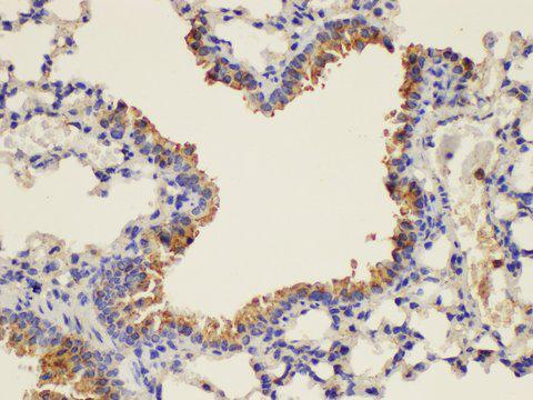 PLAUR / CD87 / uPAR Antibody - Immunohistochemistry of paraffin-embedded Mouse lung using PLAUR Ployclonal Antibody at dilution of 1:200.