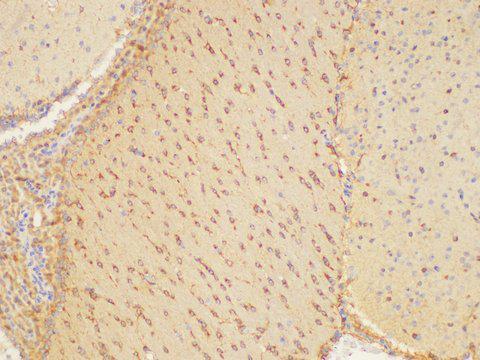 PLAUR / CD87 / uPAR Antibody - Immunohistochemistry of paraffin-embedded Mouse brain using PLAUR Ployclonal Antibody at dilution of 1:200.