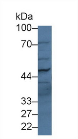 PLB1 Antibody - Western Blot; Sample: Human Serum; Primary Ab: 2µg/ml Rabbit Anti-Human PLB Antibody Second Ab: 0.2µg/mL HRP-Linked Caprine Anti-Rabbit IgG Polyclonal Antibody