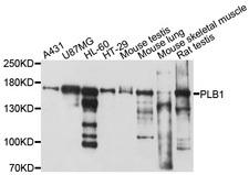 PLB1 Antibody - Western blot analysis of extracts of various cell lines, using PLB1 antibody at 1:1000 dilution. The secondary antibody used was an HRP Goat Anti-Rabbit IgG (H+L) at 1:10000 dilution. Lysates were loaded 25ug per lane and 3% nonfat dry milk in TBST was used for blocking. An ECL Kit was used for detection and the exposure time was 5s.