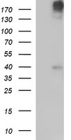 PLB1 Antibody - HEK293T cells were transfected with the pCMV6-ENTRY control (Left lane) or pCMV6-ENTRY PLB1 (Right lane) cDNA for 48 hrs and lysed. Equivalent amounts of cell lysates (5 ug per lane) were separated by SDS-PAGE and immunoblotted with anti-PLB1.