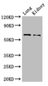 PLBD2 Antibody - Positive WB detected in:Mouse lung tissue,Mouse kidney tissue;All lanes: Plbd2 antibody at 3ug/ml;Secondary;Goat polyclonal to rabbit IgG at 1/50000 dilution;Predicted band size: 66 kDa;Observed band size: 66 kDa;