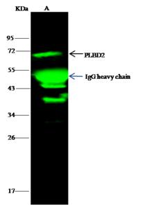 PLBD2 Antibody - PLBD2 was immunoprecipitated using: Lane A: 0.5 mg A549 Whole Cell Lysate. 1 uL anti-PLBD2 rabbit polyclonal antibody and 15 ul of 50% Protein G agarose. Primary antibody: Anti-PLBD2 rabbit polyclonal antibody, at 1:500 dilution. Secondary antibody: Dylight 800-labeled antibody to rabbit IgG (H+L), at 1:5000 dilution. Developed using the odssey technique. Performed under reducing conditions. Predicted band size: 65 kDa. Observed band size: 65 kDa.