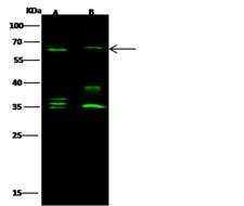 PLBD2 Antibody - Anti-PLBD2 rabbit polyclonal antibody at 1:500 dilution. Lane A: A549 Whole Cell Lysate. Lane B: 293 Whole Cell Lysate. Lysates/proteins at 30 ug per lane. Secondary: Goat Anti-Rabbit IgG H&L (Dylight 800) at 1/10000 dilution. Developed using the Odyssey technique. Performed under reducing conditions. Predicted band size: 65 kDa. Observed band size: 65 kDa. (We are unsure as to the identity of these extra bands.)