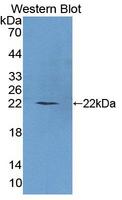PLCB1 / Phospholipase C Beta 1 Antibody - Western blot of PLCB1 / Phospholipase C Beta 1 antibody.