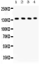 PLCB1 / Phospholipase C Beta 1 Antibody - PLCB1 antibody Western blot. All lanes: Anti PLCB1 at 0.5 ug/ml. Lane 1: Rat Brain Tissue Lysate at 50 ug. Lane 2: Mouse Brain Tissue Lysate at 50 ug. Lane 3: Mouse Testis Tissue Lysate at 50 ug. Lane 4: Human Placenta Tissue Lysate at 50 ug. Predicted band size: 139 kD. Observed band size: 139 kD.