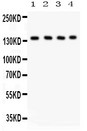 PLCB1 / Phospholipase C Beta 1 Antibody - PLCB1 antibody Western blot. All lanes: Anti PLCB1 at 0.5 ug/ml. Lane 1: Rat Brain Tissue Lysate at 50 ug. Lane 2: Mouse Brain Tissue Lysate at 50 ug. Lane 3: Mouse Testis Tissue Lysate at 50 ug. Lane 4: Human Placenta Tissue Lysate at 50 ug. Predicted band size: 139 kD. Observed band size: 139 kD.