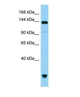 PLCB1 / Phospholipase C Beta 1 Antibody - Western blot of Plcb1 Antibody - C-terminal region in Mouse Testis cells lysate.  This image was taken for the unconjugated form of this product. Other forms have not been tested.