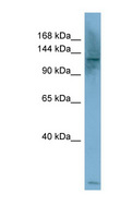 PLCB1 / Phospholipase C Beta 1 Antibody - PLCB1 antibody Western blot of HepG2 cell lysate. This image was taken for the unconjugated form of this product. Other forms have not been tested.