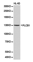 PLCB1 / Phospholipase C Beta 1 Antibody - Western blot of extracts of HL-60 cell lines, using PLCB1 antibody.