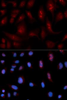PLCB1 / Phospholipase C Beta 1 Antibody - Immunofluorescence analysis of U2OS cell using PLCB1 antibody. Blue: DAPI for nuclear staining.