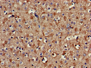 PLCB1 / Phospholipase C Beta 1 Antibody - Immunohistochemistry of paraffin-embedded human brain tissue using PLCB1 Antibody at dilution of 1:100