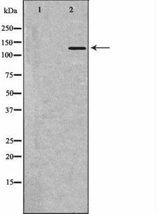 PLCB1 / Phospholipase C Beta 1 Antibody - Western blot analysis of extracts of HL-60 cells using PLCB1 antibody. The lane on the left is treated with the antigen-specific peptide.