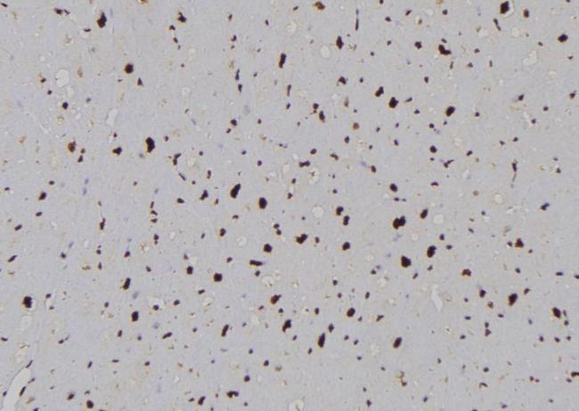 PLCB1 / Phospholipase C Beta 1 Antibody - 1:100 staining human heart tissue by IHC-P. The sample was formaldehyde fixed and a heat mediated antigen retrieval step in citrate buffer was performed. The sample was then blocked and incubated with the antibody for 1.5 hours at 22°C. An HRP conjugated goat anti-rabbit antibody was used as the secondary.