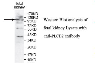 PLCB2 Antibody