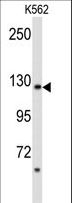 PLCB2 Antibody - Western blot of PLCB2 Antibody in K562 cell line lysates (35 ug/lane). PLCB2 (arrow) was detected using the purified antibody.