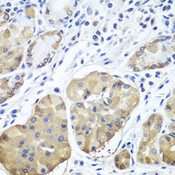 PLCB2 Antibody - Immunohistochemistry of paraffin-embedded human stomach tissue.