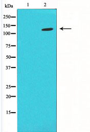 PLCB2 Antibody - Western blot analysis of extracts of K562 cells using PLCB2 antibody. The lane on the left is treated with the antigen-specific peptide.