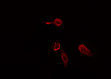 PLCB2 Antibody - Staining HeLa cells by IF/ICC. The samples were fixed with PFA and permeabilized in 0.1% Triton X-100, then blocked in 10% serum for 45 min at 25°C. The primary antibody was diluted at 1:200 and incubated with the sample for 1 hour at 37°C. An Alexa Fluor 594 conjugated goat anti-rabbit IgG (H+L) antibody, diluted at 1/600, was used as secondary antibody.