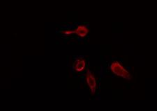 PLCB2 Antibody - Staining HeLa cells by IF/ICC. The samples were fixed with PFA and permeabilized in 0.1% Triton X-100, then blocked in 10% serum for 45 min at 25°C. The primary antibody was diluted at 1:200 and incubated with the sample for 1 hour at 37°C. An Alexa Fluor 594 conjugated goat anti-rabbit IgG (H+L) antibody, diluted at 1/600, was used as secondary antibody.