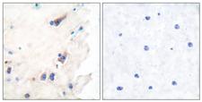 PLCB3 Antibody - Immunohistochemistry analysis of paraffin-embedded human brain tissue, using PLCB3 Antibody. The picture on the right is blocked with the synthesized peptide.