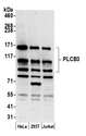 PLCB3 Antibody - Detection of human PLCB3 by western blot. Samples: Whole cell lysate (15 µg) from HeLa, HEK293T, and Jurkat cells prepared using NETN lysis buffer. Antibody: Affinity purified rabbit anti-PLCB3 antibody used for WB at 0.1 µg/ml. Detection: Chemiluminescence with an exposure time of 3 minutes.