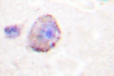 PLCB3 Antibody - IHC of PLC 3 (D1099) pAb in paraffin-embedded human brain tissue.
