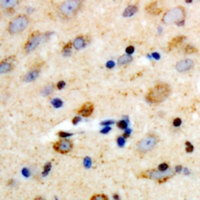 PLCB3 Antibody - Immunohistochemical analysis of PLC beta 3 staining in human brain formalin fixed paraffin embedded tissue section. The section was pre-treated using heat mediated antigen retrieval with sodium citrate buffer (pH 6.0). The section was then incubated with the antibody at room temperature and detected using an HRP polymer system. DAB was used as the chromogen. The section was then counterstained with hematoxylin and mounted with DPX.
