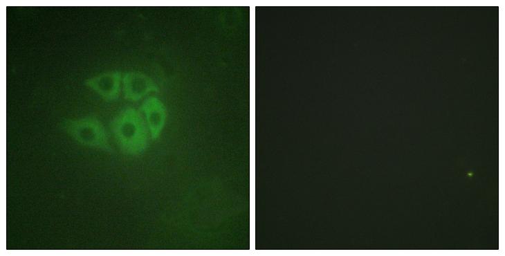 PLCB3 Antibody - Peptide - + Immunofluorescence analysis of A549 cells, using PLC ß3 antibody.