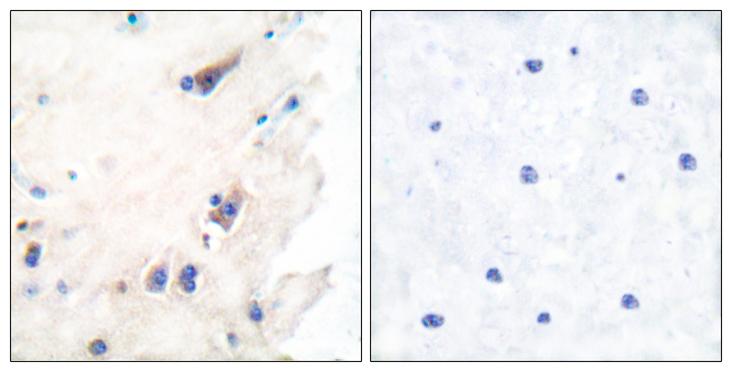 PLCB3 Antibody - Peptide - + Immunohistochemical analysis of paraffin-embedded human brain tissue using PLC-ß (Ab-1105) antibody.