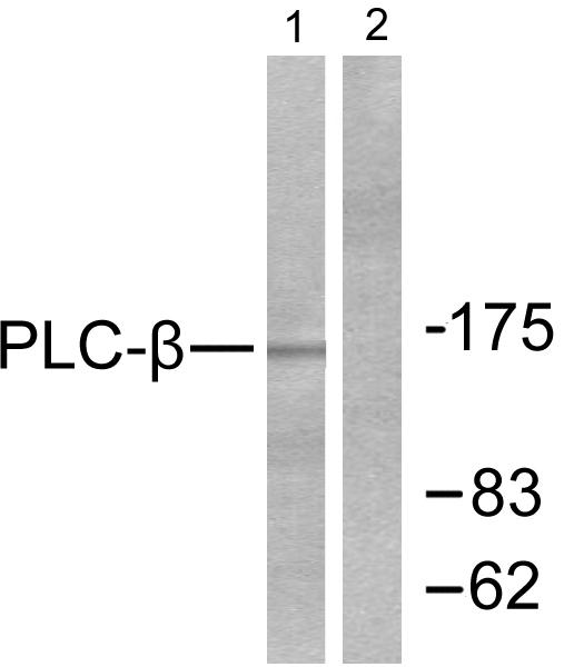 PLCB3 Antibody - Western blot analysis of extracts from HeLa cells treated with PMA (125ng/ml, 30min), using PLC-ß (Ab-1105) antibody ( Line 1 and 2).