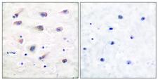 PLCB3 Antibody - Immunohistochemistry analysis of paraffin-embedded human brain, using PLCB3 (Phospho-Ser1105) Antibody. The picture on the right is blocked with the phospho peptide.
